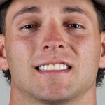 A Highly Touted Prospect